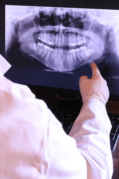 Best Emergency Root Canal Treatment in Kechi, KS