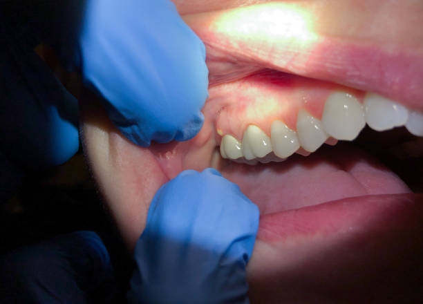 Best Emergency Treatment for Toothache in Kechi, KS