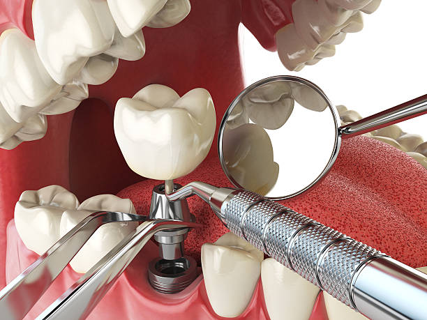 Best Walk-In Emergency Dentist in Kechi, KS