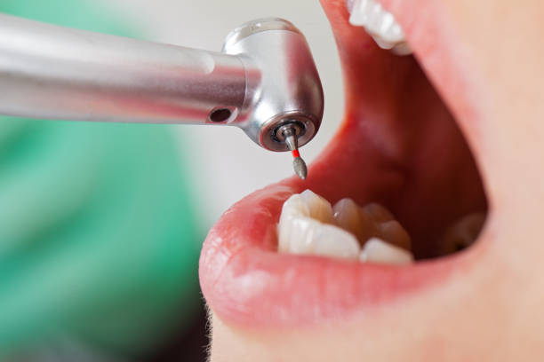Best Emergency Dental Surgery in Kechi, KS
